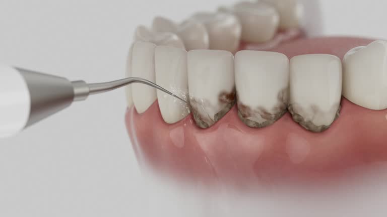 Trusted Wisdom Tooth Removal service in Telford, TN - Dentist Open Now